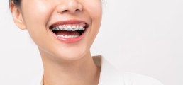 Ubytki klinowe zębów - co to takiego? Objawy i przyczyny powstania